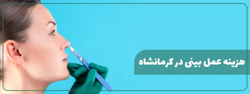 هزینه عمل بینی در کرمانشاه
